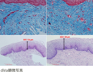 diva顕微鏡写真