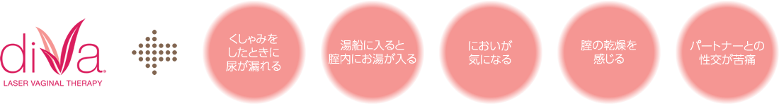 くしゃみをしたときに尿が漏れる/湯船に入ると腟内にお湯が入る/ においが気になる/ 腟の乾燥を感じる/ パートナーとの性交が苦痛